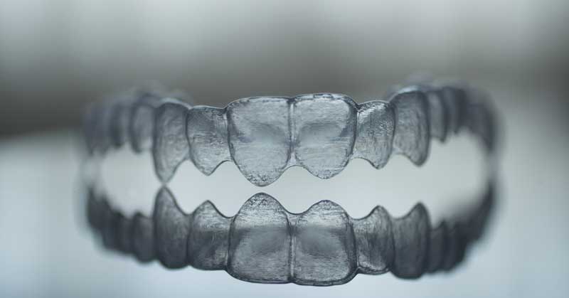 5 Hacks That Everyone With Invisalign Should Know - Taylor Dentist