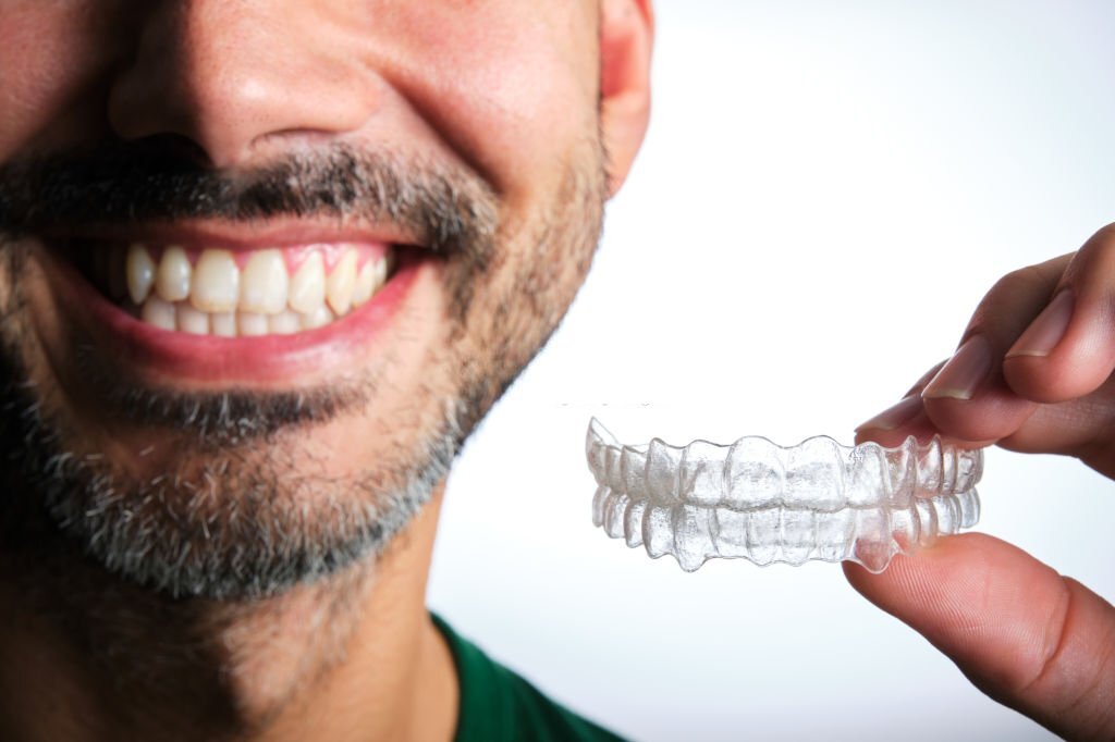 All That You Need to Know About Wisdom Teeth & Braces