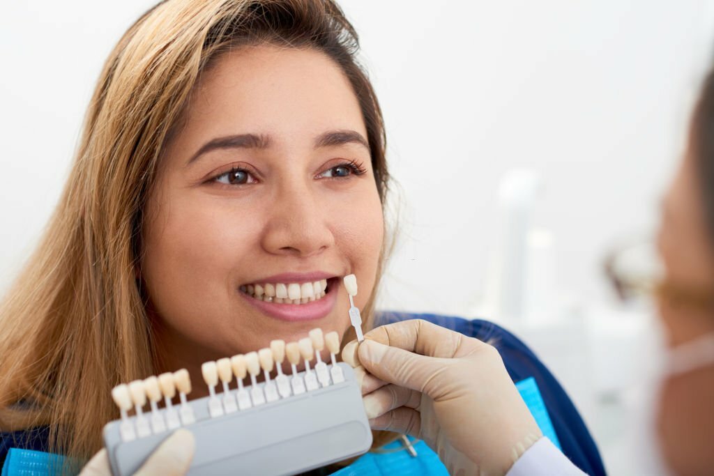 What Are The Benefits Of Dental Veneers?