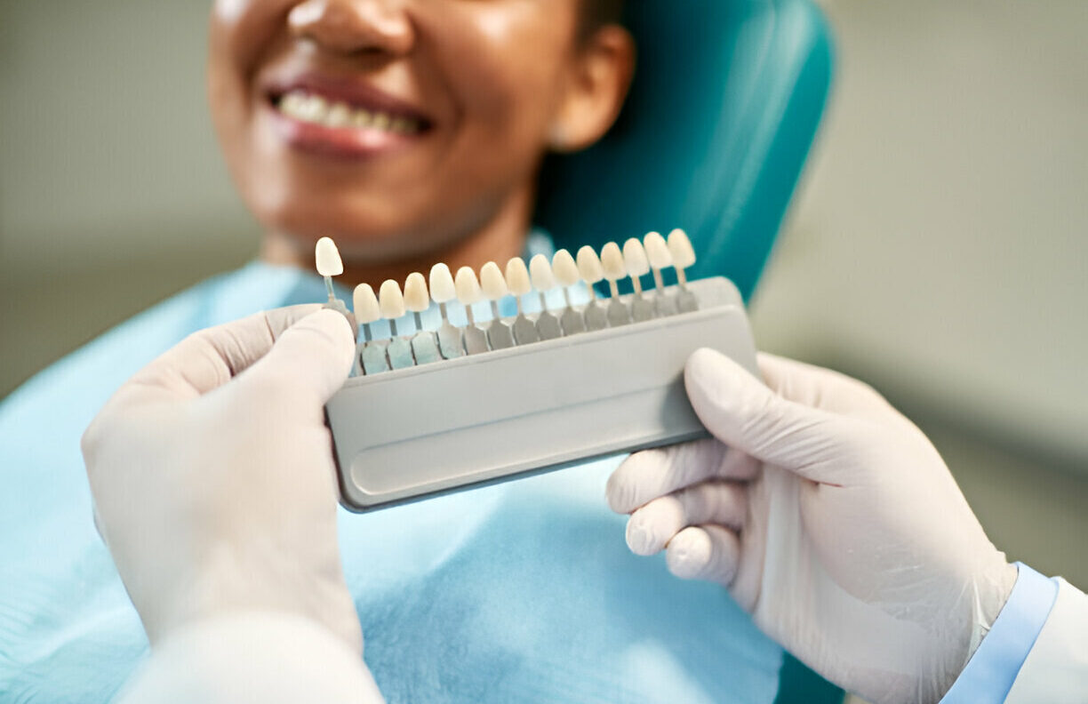 From Consultation to Smile Makeover: How Taylor Dental and Braces Offers the Best Dental Veneers in Texas_FI
