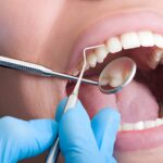 How Routine Exams & Cleanings Improve Long-Term Oral Health - Taylor Dental and Braces_FI