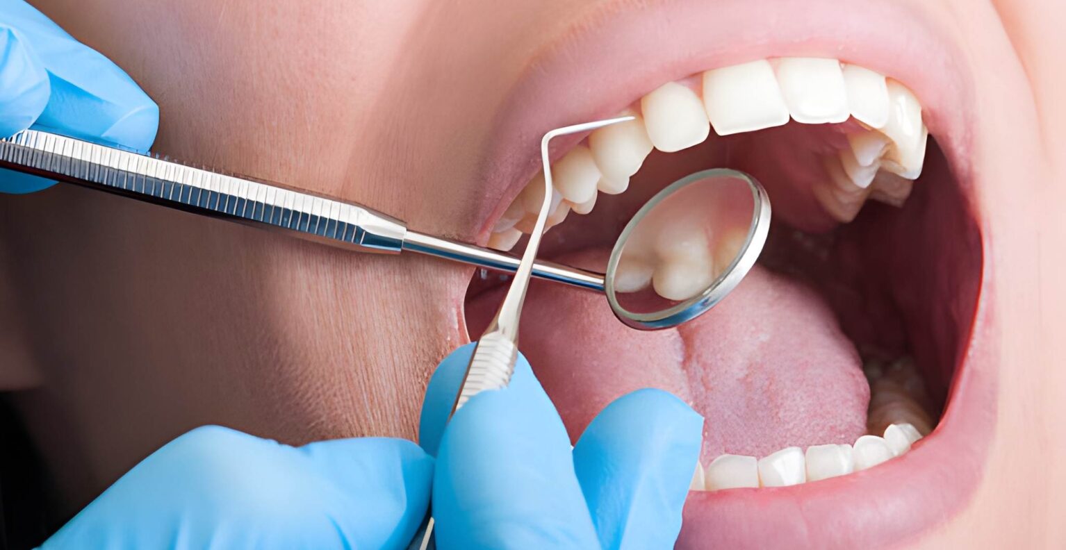 How Routine Exams & Cleanings Improve Long-Term Oral Health - Taylor Dental and Braces_FI