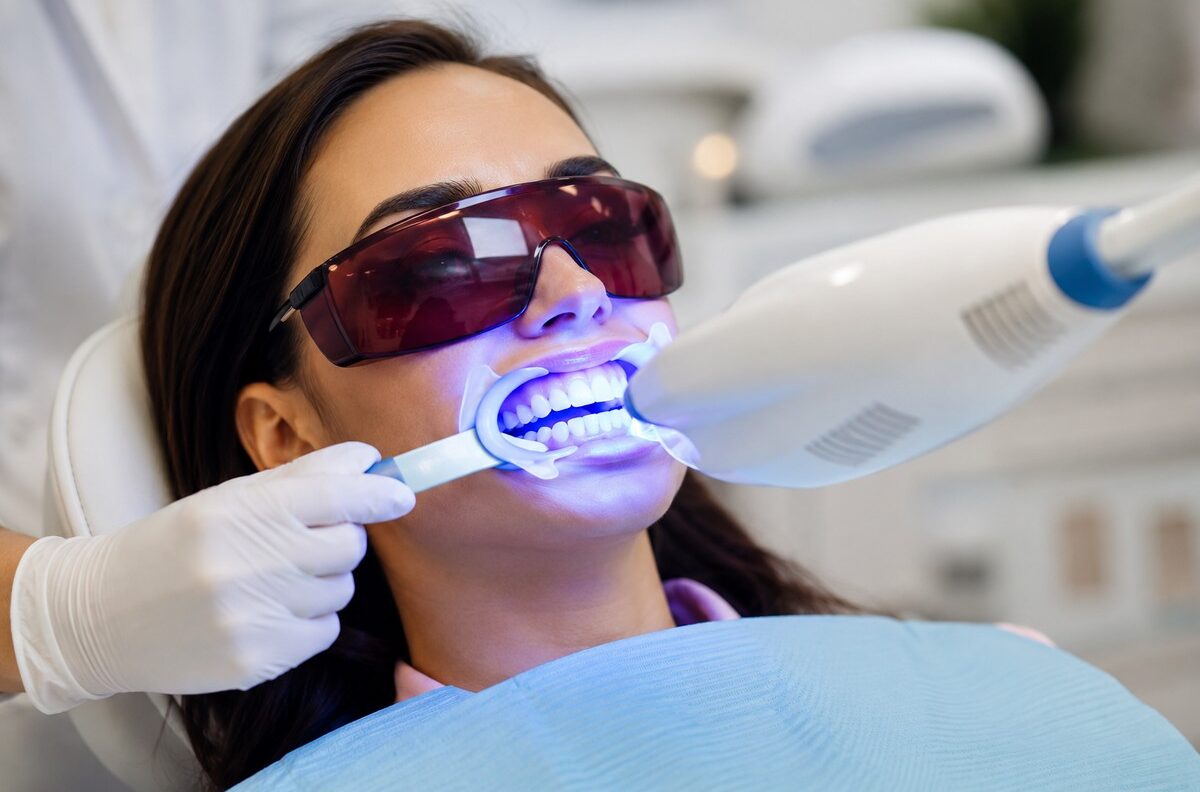 Professional Teeth Whitening Work at a Dentist